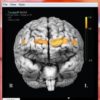 fNIR visualisation over brain surface