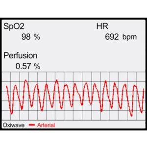 Pulse oximetry